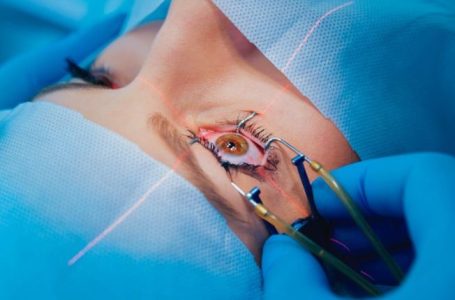 Benefits Of A LASIK Surgeon You Must Know